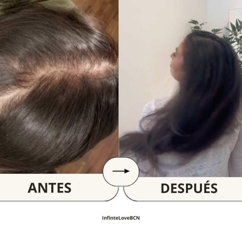 InfiniteShampoo® - Anticaída
