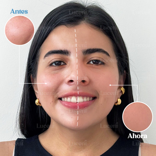 InfiniteBella® - Luminosidad Natural