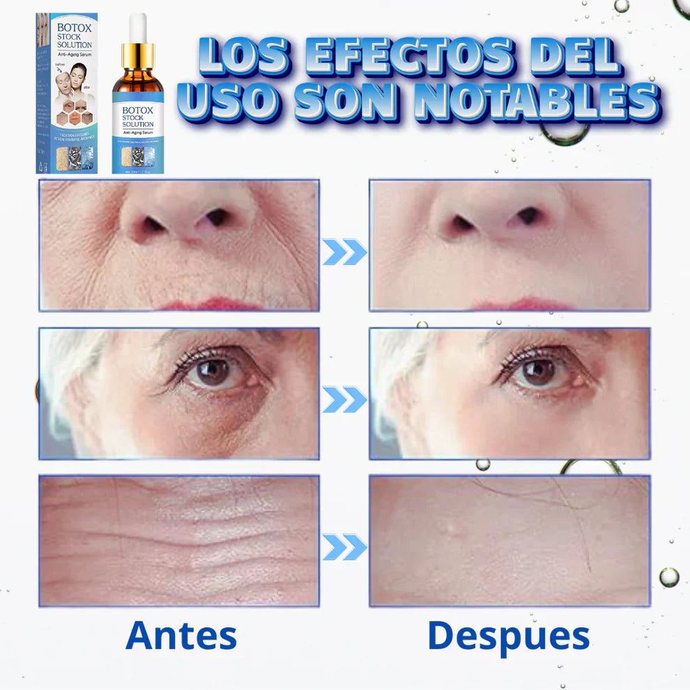 Sérum Magic Botox®
